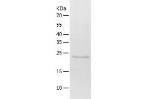 Western Blotting (WB) image for Pyruvate Dehydrogenase Kinase, Isozyme 4 (PDK4) (AA 138-368) protein (His tag) (ABIN7124722) (PDK4 Protein (AA 138-368) (His tag))