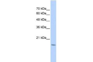 WB Suggested Anti-CDC42EP5 Antibody Titration: 0.