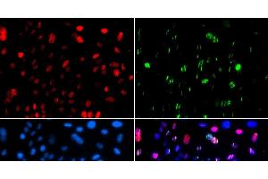 Immunofluorescence (IF) image for anti-Tumor Protein P53 (TP53) (pSer15) antibody (ABIN7265078)