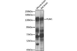 Western blot analysis of extracts of various cell lines, using PUM1 antibody (ABIN2737436) at 1:1000 dilution. (PUM1 antibody)