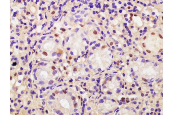 CDCA2 antibody  (AA 361-450)