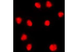 Immunofluorescent analysis of FOXC1/2 staining in THP1 cells. (FOXC1 antibody  (Center))