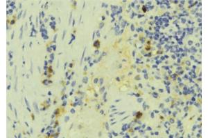 ABIN6272891 at 1/100 staining Human lymph tissue by IHC-P. (IFT57 antibody  (Internal Region))