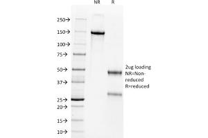 SDS-PAGE Analysis Purified Wilm's Tumor Mouse Monoclonal Antibody (WT1/857). (WT1 antibody)