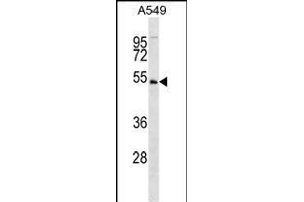 UHMK1 Antikörper  (N-Term)