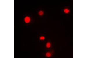 Immunofluorescent analysis of KLF11 staining in HL60 cells. (KLF11 antibody  (N-Term))