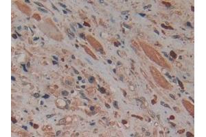 Immunohistochemistry (IHC) image for anti-Minichromosome Maintenance Complex Component 5 (MCM5) (AA 331-537) antibody (ABIN7435823)