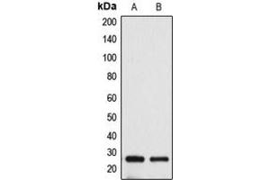 Western blot analysis of BAK expression in HeLa (A), A431 (B) whole cell lysates. (BAK1 antibody  (N-Term))