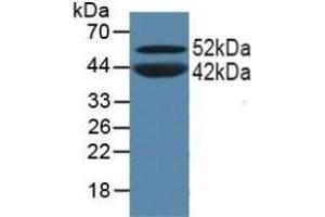 Detection of PPARa in Porcine Skeletal Muscle Tissue using Polyclonal Antibody to Peroxisome Proliferator Activated Receptor Alpha (PPARa) (PPARA antibody  (AA 61-170))