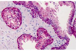 Human Prostate: Formalin-Fixed, Paraffin-Embedded (FFPE) (COMT antibody  (AA 52-65))