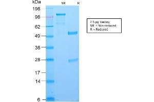 SDS-PAGE Analysis Purified BCL-6 Rabbit Recombinant Monoclonal Antibody (BCL6/2497R). (Recombinant BCL6 antibody  (AA 256-389))