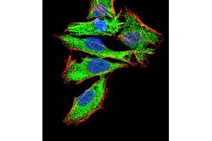 Immunofluorescence analysis of Hela cells using GNAS mouse mAb (green).