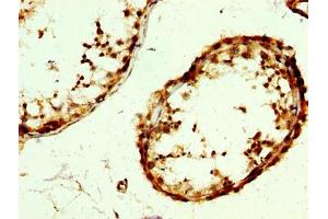 IHC image of ABIN7166997 diluted at 1:300 and staining in paraffin-embedded human testis tissue performed on a Leica BondTM system. (RAB3GAP2 antibody  (Catalytic Subunit))