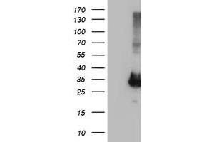 Image no. 1 for anti-Phenylethanolamine N-Methyltransferase (PNMT) antibody (ABIN1500316) (PNMT antibody)
