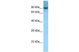 WB Suggested Anti-Aacs Antibody Titration: 1. (AACS antibody  (Middle Region))