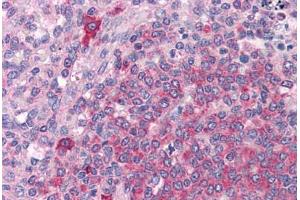 Human Spleen: Formalin-Fixed, Paraffin-Embedded (FFPE) (BTK antibody  (AA 91-387))