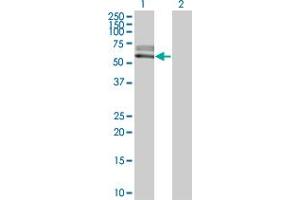 Western Blot analysis of ACVRL1 expression in transfected 293T cell line by ACVRL1 monoclonal antibody (M06), clone 2C12.