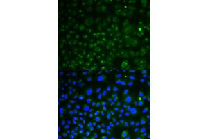 Immunofluorescence analysis of HeLa cells using LAMP1 antibody (ABIN5998110). (LAMP1 antibody)