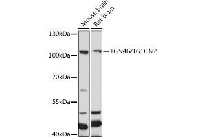 Western blot analysis of extracts of various cell lines, using TGN46/TGN46/TGOLN2 antibody (ABIN7270876) at 1:1000 dilution. (TGOLN2 antibody)