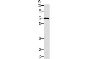 Western Blotting (WB) image for anti-Plastin 3 (PLS3) antibody (ABIN2423979)