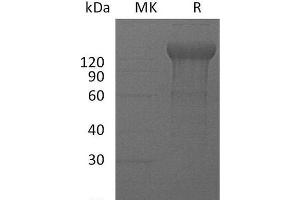 IL12RB2 Protein (Fc Tag)
