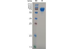 Human GP6 Protein, hFc Tag on SDS-PAGE under reducing condition. (GP6 Protein (AA 21-267) (Fc Tag))