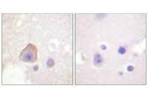 Immunohistochemical analysis of paraffin-embedded human brain tissue using ADD1 (Ab-726) antibody. (alpha Adducin antibody  (Ser726))