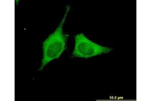 Immunofluorescence of monoclonal antibody to BRAF on HeLa cell. (BRAF antibody  (AA 138-231))