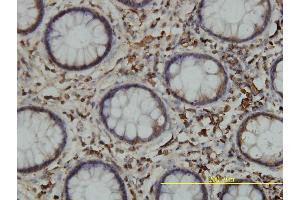 Immunoperoxidase of monoclonal antibody to CALR on formalin-fixed paraffin-embedded human colon tissue. (Calreticulin antibody  (AA 1-417))