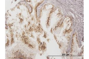Immunoperoxidase of monoclonal antibody to ABCC4 on formalin-fixed paraffin-embedded human prostate. (ABCC4 antibody  (AA 1-110))