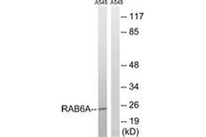 Western blot analysis of extracts from A549 cells, using RAB6A Antibody. (RAB6A antibody  (AA 113-162))