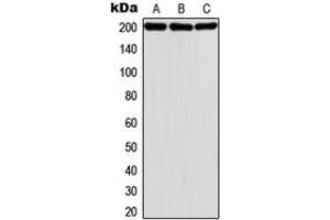 Western blot analysis of MADD expression in HeLa (A), A431 (B), K562 (C) whole cell lysates. (MADD antibody  (Center))