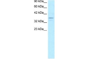 WB Suggested Anti-TAF7 Antibody Titration:  5. (TAF7 antibody  (N-Term))