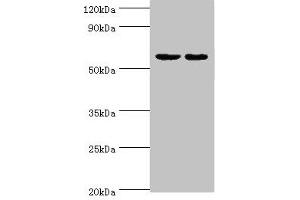 Western blot All lanes: Diacylglycerol kinase epsilon antibody at 5 μg/mL Lane 1: Rat brain tissue Lane 2: Hela whole cell lysate Secondary Goat polyclonal to rabbit IgG at 1/10000 dilution Predicted band size: 64, 21 kDa Observed band size: 64 kDa (DGKE antibody  (AA 40-260))