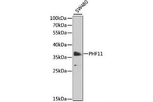 Western blot analysis of extracts of SW480 cells using PHF11 Polyclonal Antibody at dilution of 1:1000. (PHF11 antibody)