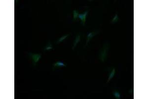 DIXDC1 antibody