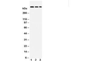 Western blot testing of LAMA2 antibody and Lane 1:  HeLa (Laminin antibody  (AA 152-170))