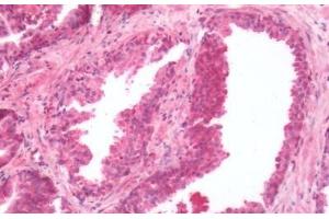 Human Prostate: Formalin-Fixed, Paraffin-Embedded (FFPE) (EDG4 antibody  (Cytoplasmic Domain))