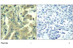 Image no. 1 for anti-Phospholipase C gamma 2 (PLCG2) (Tyr1217) antibody (ABIN319401) (Phospholipase C gamma 2 antibody  (Tyr1217))