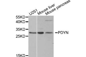 Western blot analysis of extracts of various cell lines, using PDYN antibody.