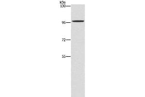 Western Blot analysis of A172 cell using PDE6C Polyclonal Antibody at dilution of 1:1400 (PDE6C antibody)