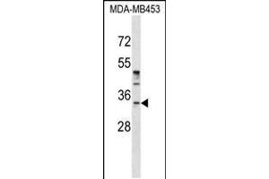 Western blot analysis in MDA-MB453 cell line lysates (35ug/lane). (POU6F1 antibody  (N-Term))