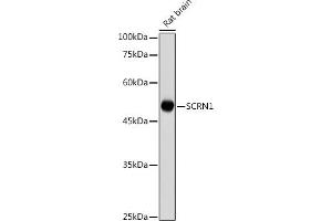 Western blot analysis of extracts of Rat brain , using SCRN1 antibody (ABIN7270175) at 1:1000 dilution. (Secernin 1 antibody)