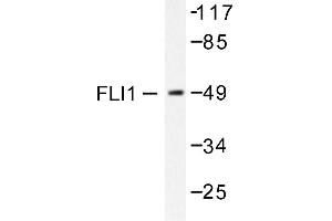 Image no. 1 for anti-Friend Leukemia Virus Integration 1 (FLI1) antibody (ABIN265422) (FLI1 antibody)