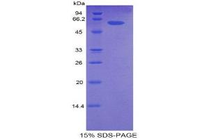 SDS-PAGE (SDS) image for Cyclin-Dependent Kinase 2 (CDK2) (AA 93-211) protein (His tag,MBP tag) (ABIN2123770)