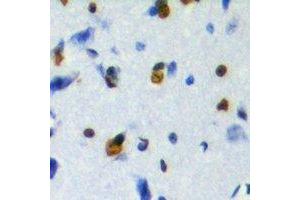 Immunohistochemical analysis of ZFP95 staining in human brain formalin fixed paraffin embedded tissue section. (ZKSCAN5 antibody)