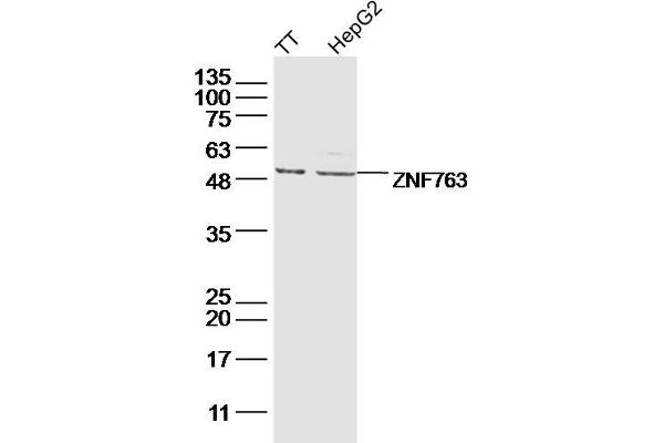 ZNF763 antibody  (AA 301-394)