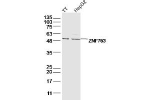 Lane 1: TT lysates Lane 2: hepg2 lysates probed with ZNF763 Polyclonal Antibody, Unconjugated  at 1:300 dilution and 4˚C overnight incubation. (ZNF763 antibody  (AA 301-394))