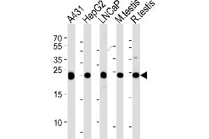 Western blot analysis of lysates from A431, HepG2, LNCaP cell line and mouse testis, rat testis tissue lysates (from left to right), using TPI1 Antibody (C-term) (ABIN389458 and ABIN2839525).