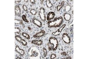 Immunohistochemical staining of human kidney with KCNE3 polyclonal antibody  shows strong cytoplasmic positivity in granular pattern in tubular cells at 1:500-1:1000 dilution.